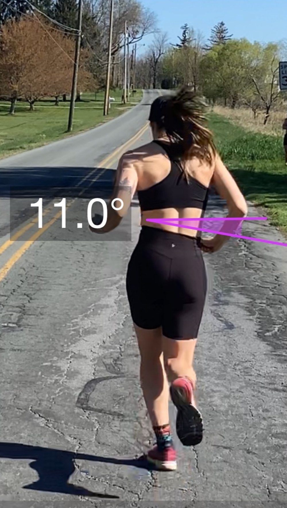 Posterior-view gait analysis frame with an 11.0 degree pelvic drop measurement annotated